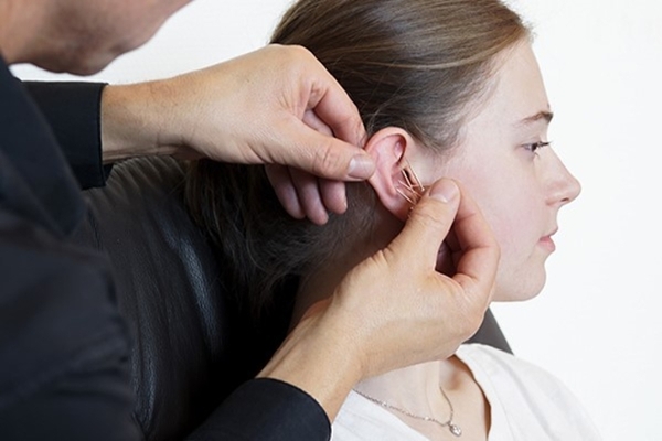 Therapeut akupunktiert das Ohr einer Frau